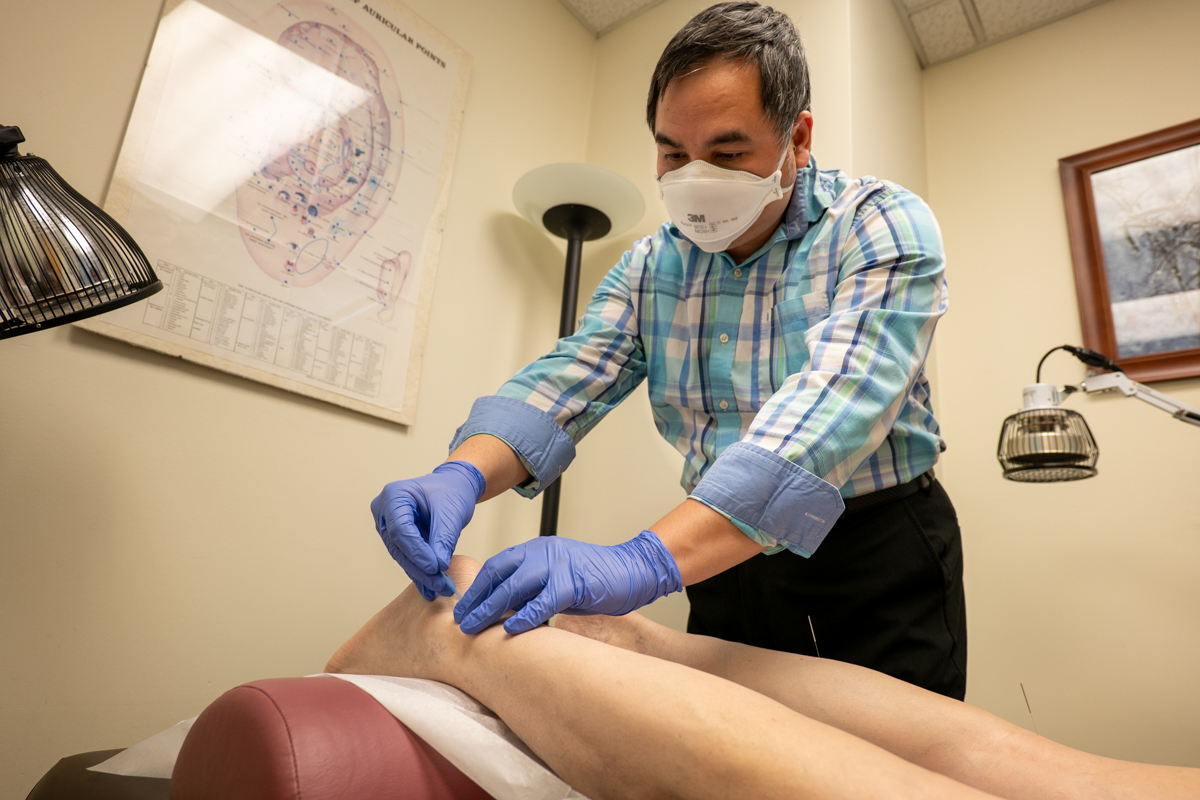 The ABCs of Acupuncture